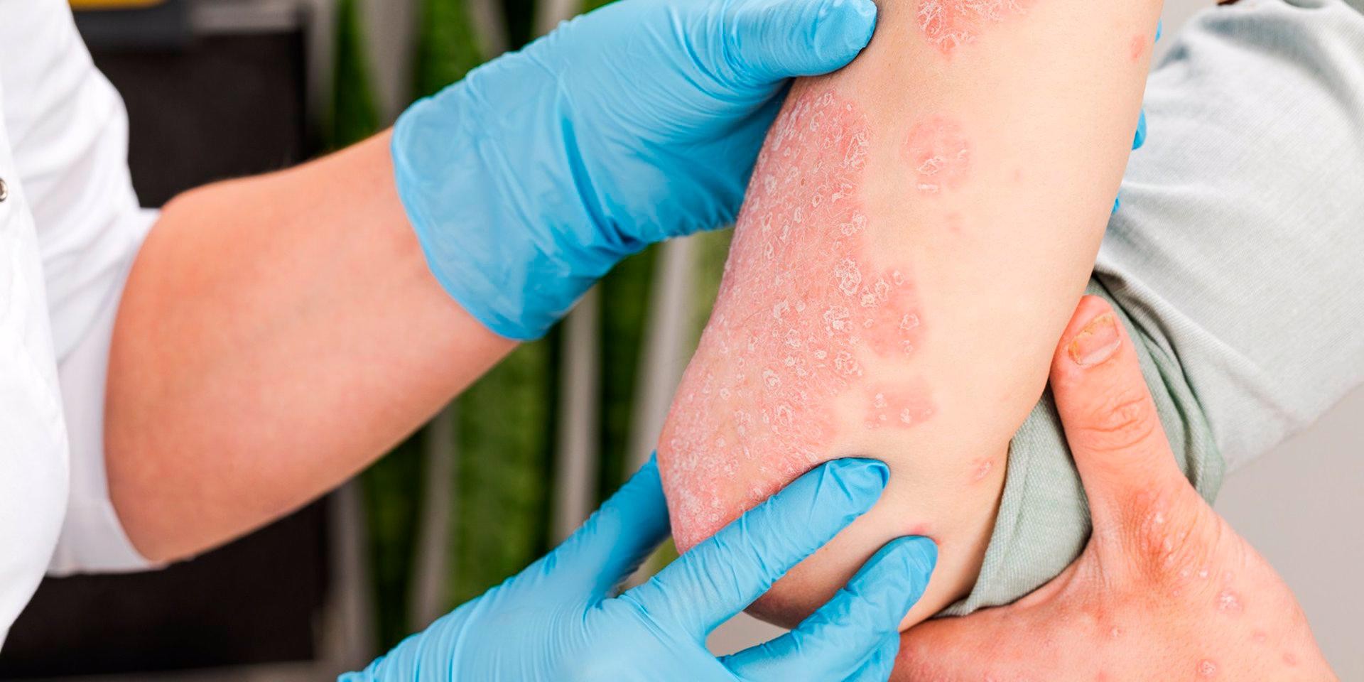 Dermatological emergencies: a step by step guide to diagnosis and management
